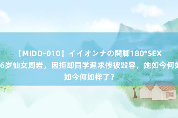 【MIDD-010】イイオンナの開脚180°SEX LISA 16岁仙女周岩，因拒却同学追求惨被毁容，她如今何如样了？